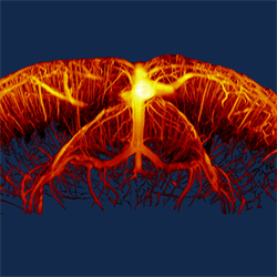 3D volumetric ultrasound captures data on both depth and motion in real time. This example shows the network of tiny blood vessels in a mouse brain.