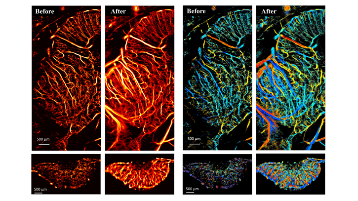 Ultrasound images of chicken embryo brains and tumors before and after microbubble separation processing.&nbsp;&lt;em&gt;Published in Scientific Reports.&nbsp;&lt;/em&gt;