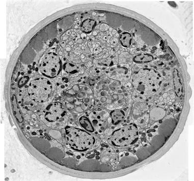 Stitched together micrographs of a soybean cyst nematode.