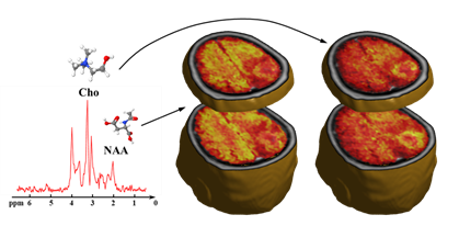 Illustration of Guo's method to generate 3D high-resolution brain metabolite maps from the tissue intrinsic spectroscopic signals.