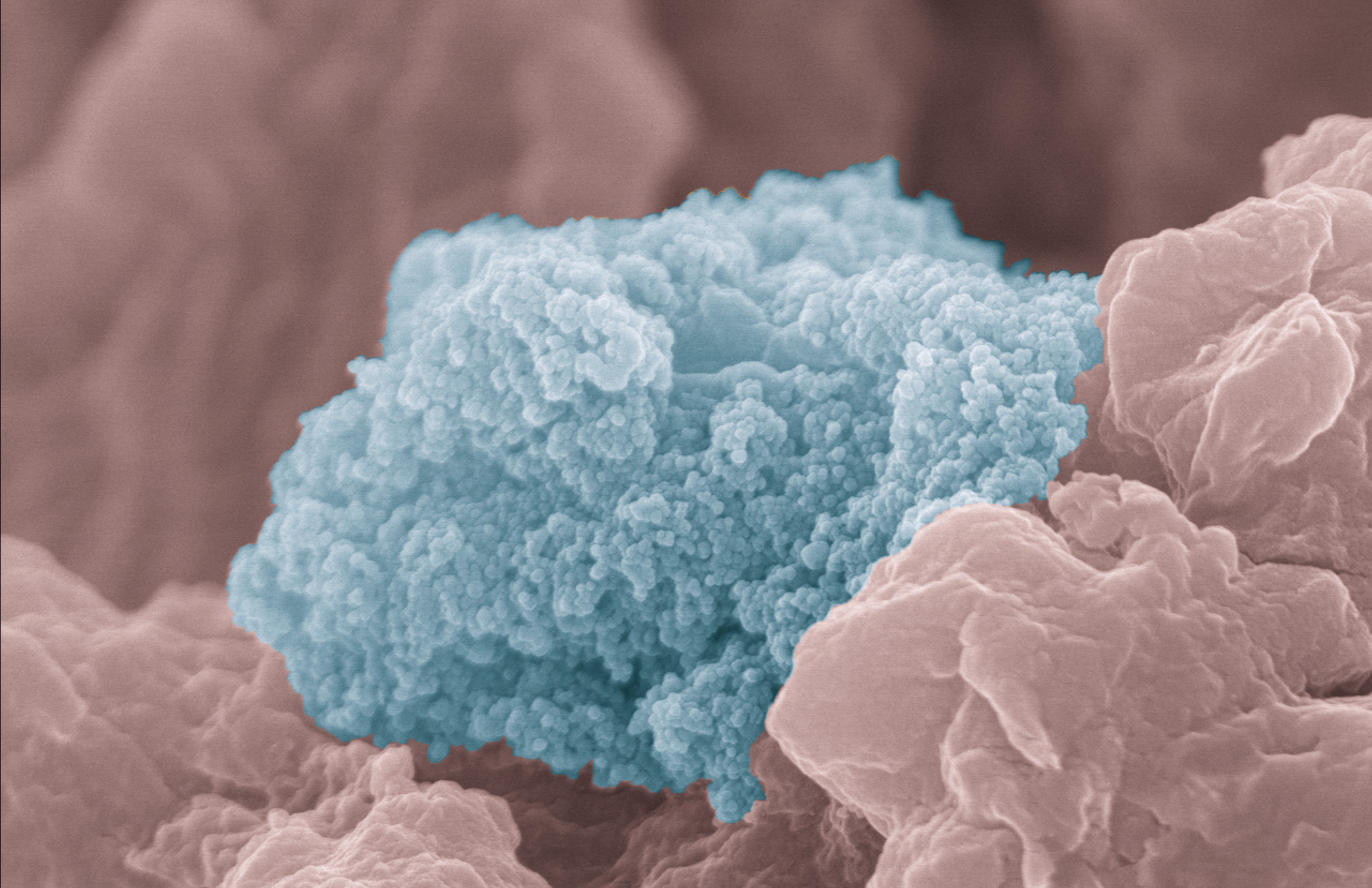 These particles (blue), thousands of times smaller than a human hair, could hold the key to solving a host of medical issues, from improving vaccines to treating cancer. 