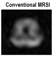 A conventional scan for biochemicals in the brain, revealing little due to its low resolution. 