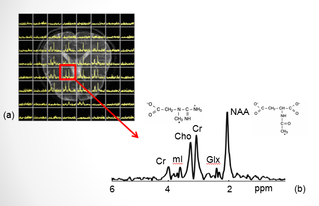 A scan for biochemicals using Lam's method, which reveals much more information about levels of different molecules in the brain.