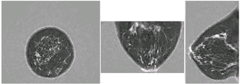 &lt;em&gt;Images showing coronal, axial, and sagittal speed of sound images of the breast, taken with the QT Imaging scanner.&lt;/em&gt;