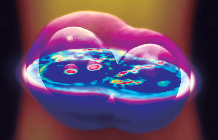 Spatial light interference microscopy of a cell enables label-free phase-based imaging without the addition of perturbative dyes or stains. Image courtesy of the Quantitative Light Imaging Laboratory and the Center for Label-free Imaging and Multi-scale Biophotonics, or CLIMB.