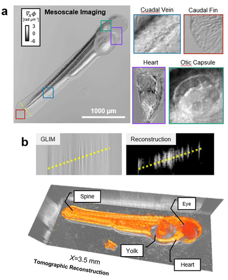 The new imaging technique (Epi-GLIM) can be used for quantitative phase imaging of whole animals. At the top, a QPI tomogram of a free-swimming larval zebrafish is shown six days post fertilization (5x/0.13) with highlighted organ scale structures. Images below show tomographic reconstruction performed using slice-by-slice high-pass filtering that provides a more detailed image for visualization purposes. (Image courtesy Gabriel Popescu)